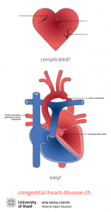 congenital-heart-disease_1